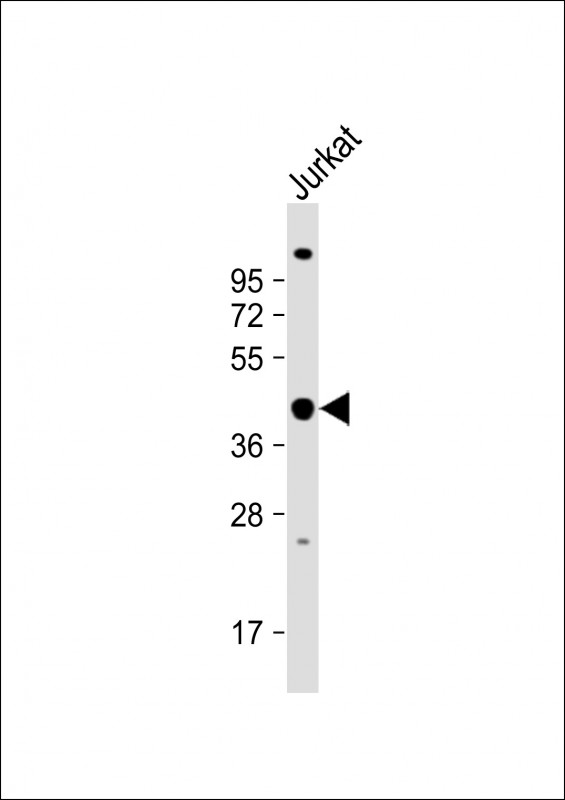 Rabbit Polyclonal Antibody to PSMD13