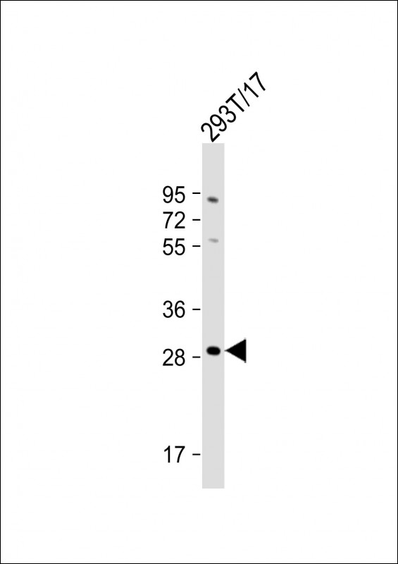 Rabbit Polyclonal Antibody to RRAGD