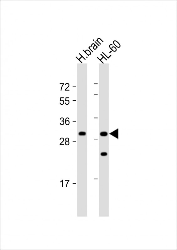 Rabbit Polyclonal Antibody to FGFBP3