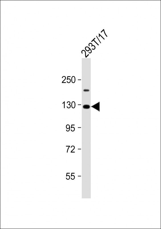 Rabbit Polyclonal Antibody to VLDLR