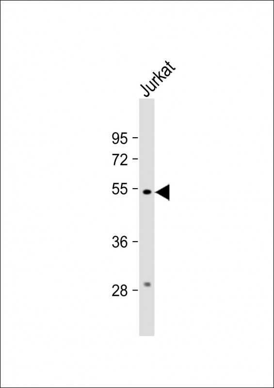 Rabbit Polyclonal Antibody to C13orf18