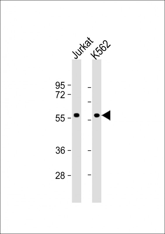 Rabbit Polyclonal Antibody to MEF2C (S396)