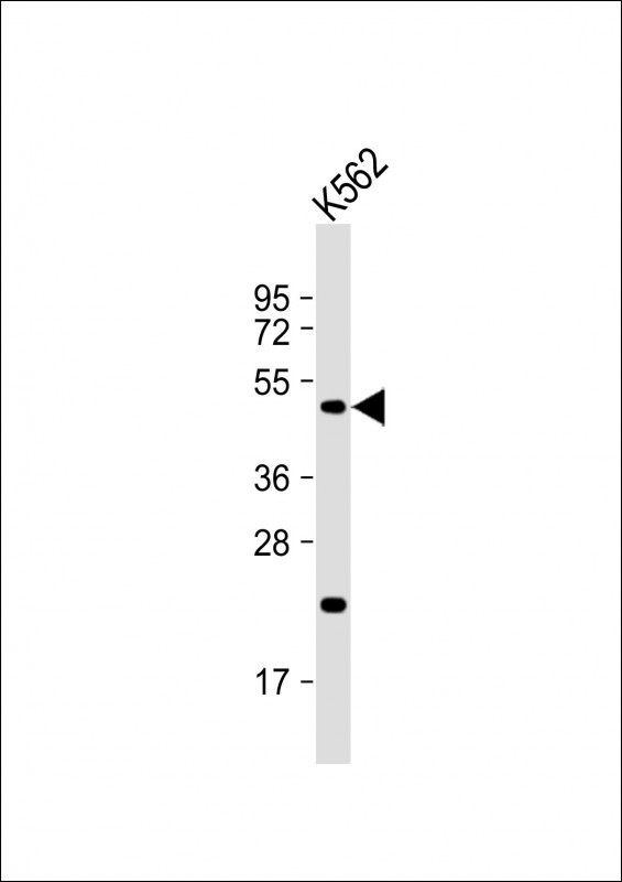 Rabbit Polyclonal Antibody to ATF4 (S245)