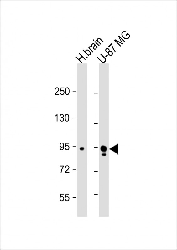 Rabbit Polyclonal Antibody to Synphilin-1 (SNCAIP)