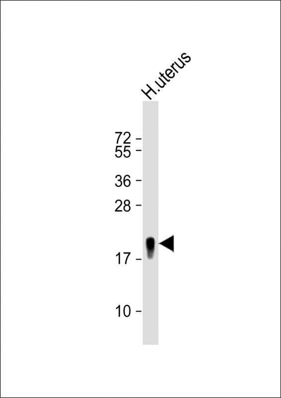 Rabbit Polyclonal Antibody to TAGLN (N-term)