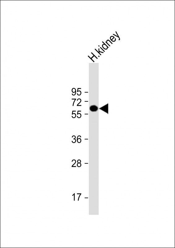 Rabbit Polyclonal Antibody to ETFDH (N-term)