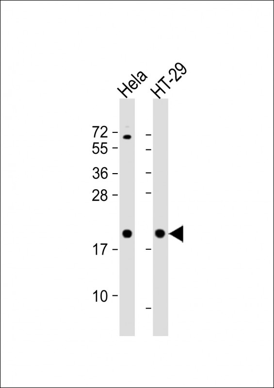 Rabbit Polyclonal Antibody to FTH1