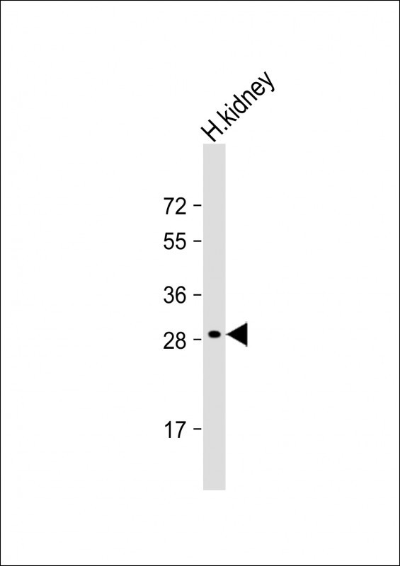 Rabbit Polyclonal Antibody to DIO1 (N-term)