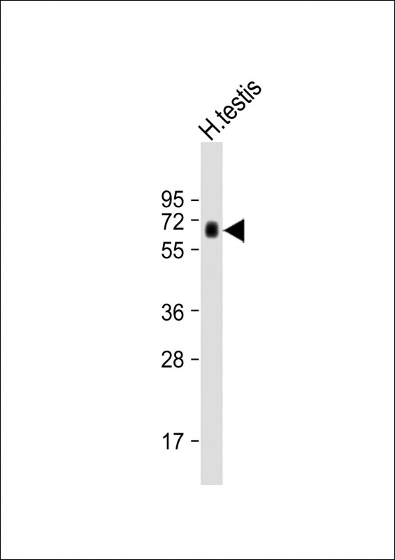 Rabbit Polyclonal Antibody to HIPK4