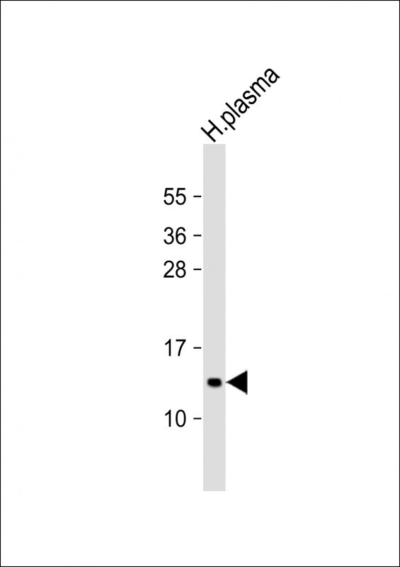 Rabbit Polyclonal Antibody to APOC3
