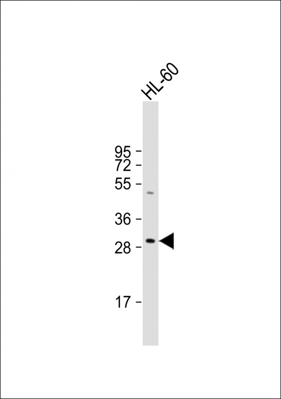 Rabbit Polyclonal Antibody to HLA-DRB5