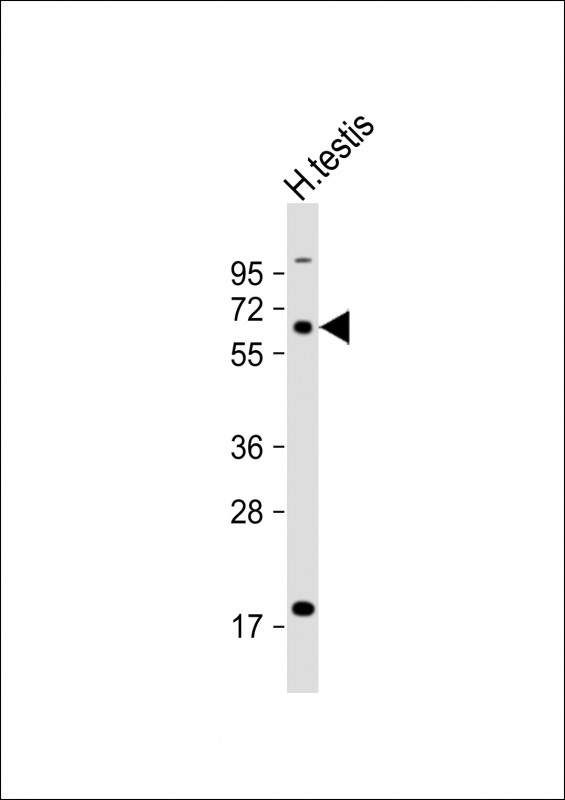 Rabbit Polyclonal Antibody to ACBG2