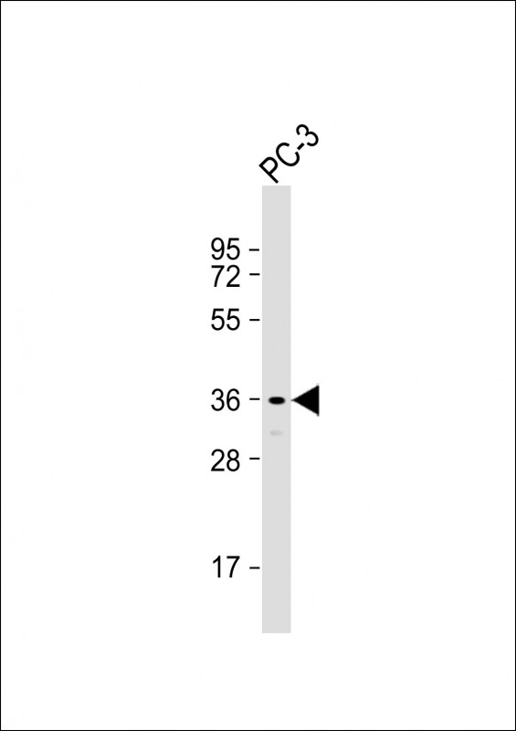 Rabbit Polyclonal Antibody to SPDYA