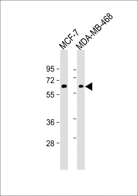 Mouse Monoclonal Antibody to PRKAA1