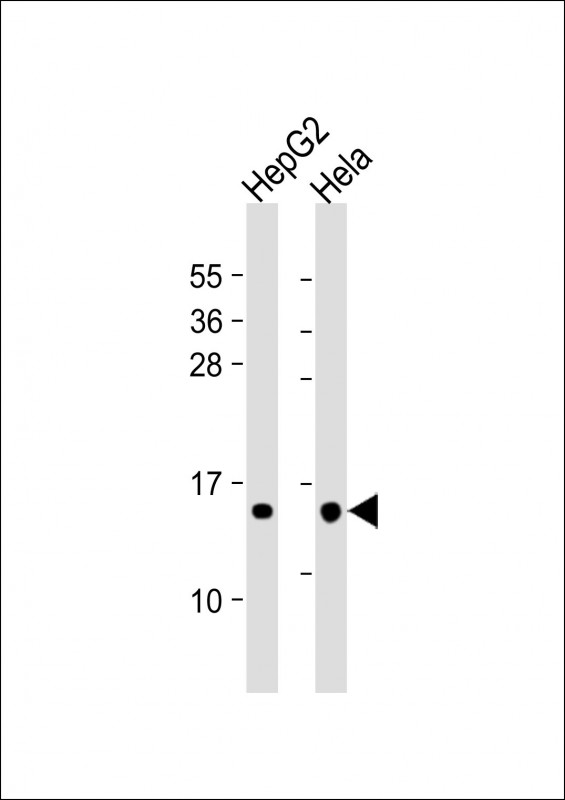 Mouse Monoclonal Antibody to THEM2
