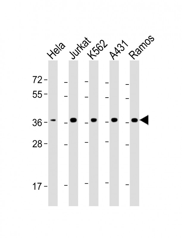 Mouse Monoclonal Antibody to RAD51