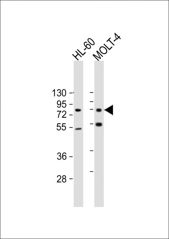 Mouse Monoclonal Antibody to CBFA2T3