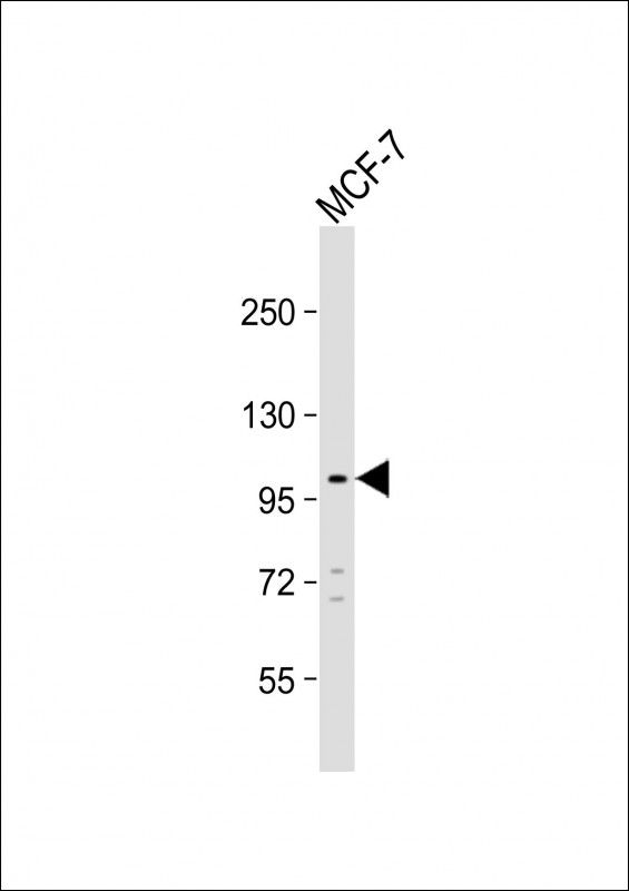 Rabbit Polyclonal Antibody to TTC16 (N-term)