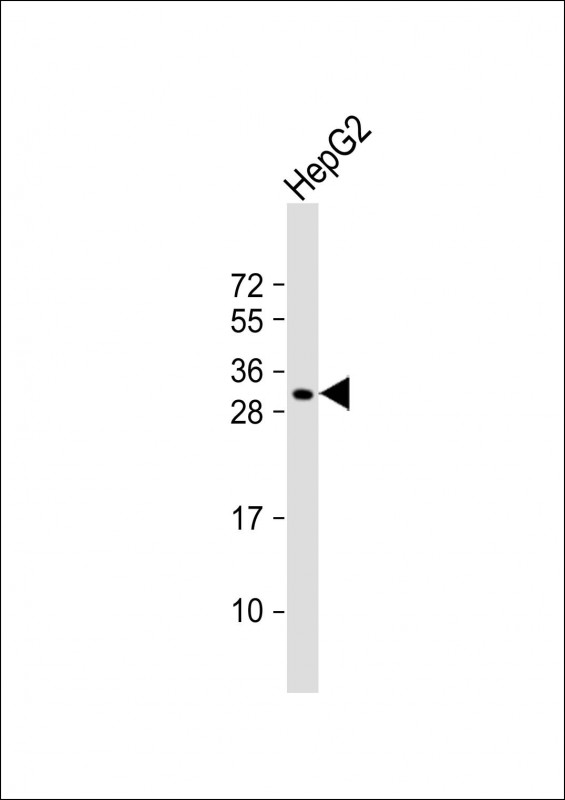 Rabbit Polyclonal Antibody to CES4 (N-term)