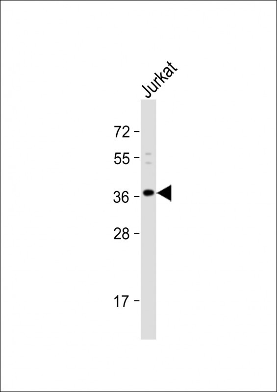 Rabbit Polyclonal Antibody to OR8B8