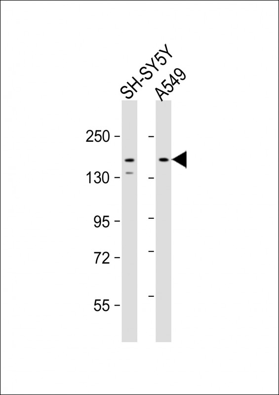 Rabbit Polyclonal Antibody to CE164 (N-term)