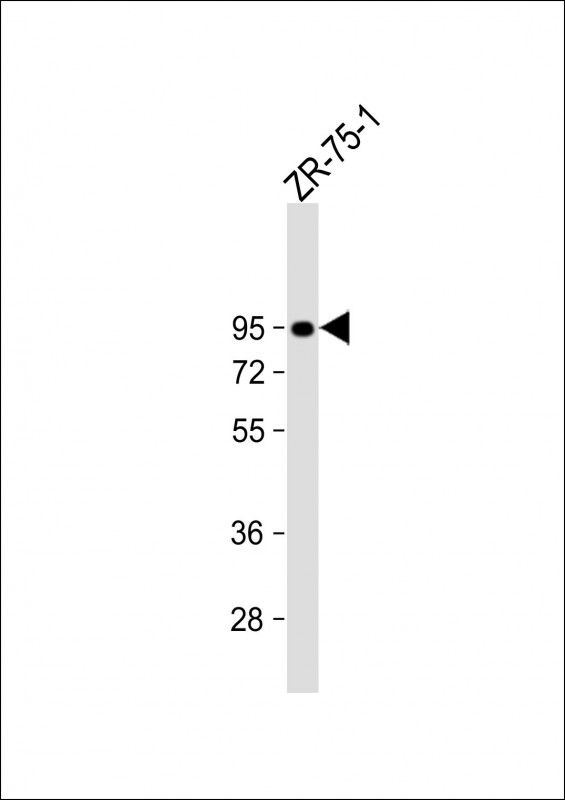 Rabbit Polyclonal Antibody to SSH3