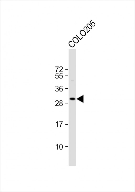 Rabbit Polyclonal Antibody to CCDC117