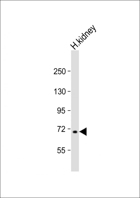 Rabbit Polyclonal Antibody to MLL5 (N-term)