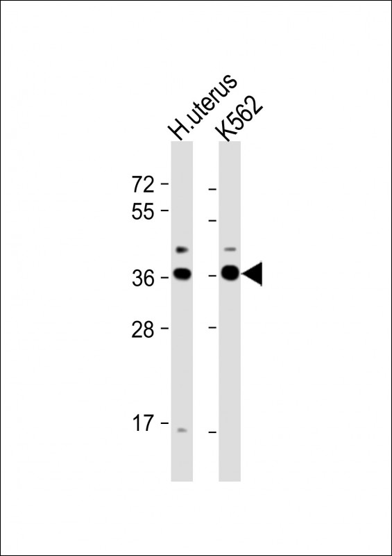 Rabbit Polyclonal Antibody to OR52H1