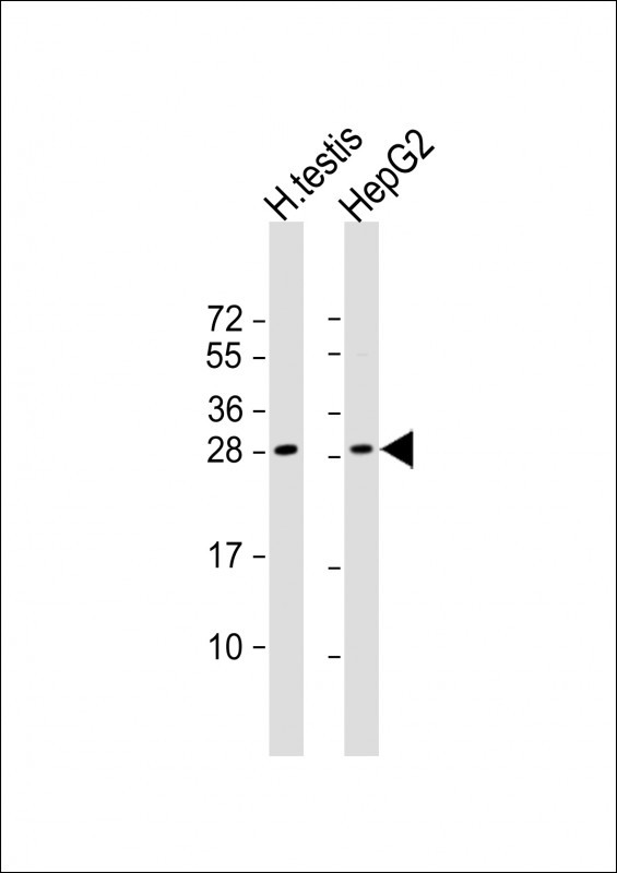 Rabbit Polyclonal Antibody to LIN28B (N-term)