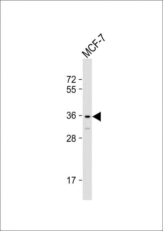 Rabbit Polyclonal Antibody to OR2T11