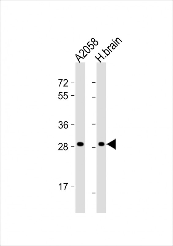 Rabbit Polyclonal Antibody to OR4F17 (N-term)