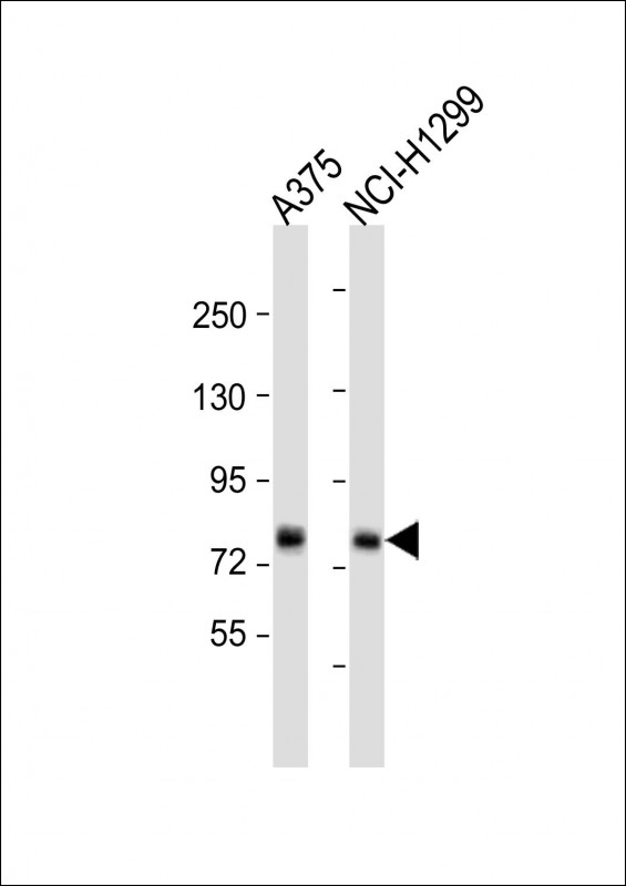 Rabbit Polyclonal Antibody to TAS1R1