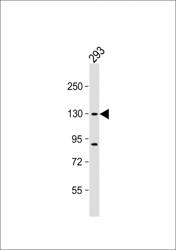 Rabbit Polyclonal Antibody to DHX30 (N-term)