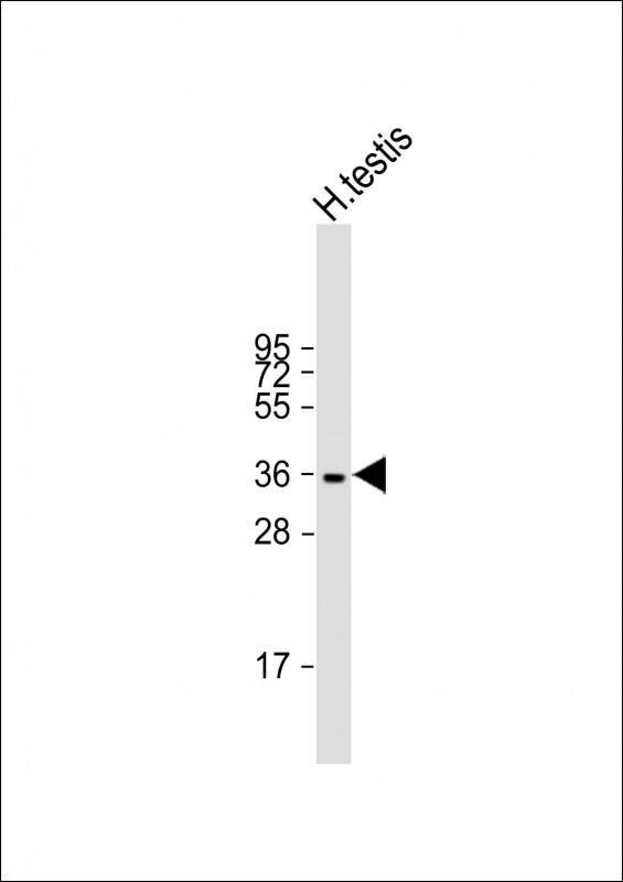 Rabbit Polyclonal Antibody to WBP2NL (N-term)