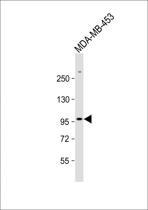 Rabbit Polyclonal Antibody to ZBTB49 (N-term)