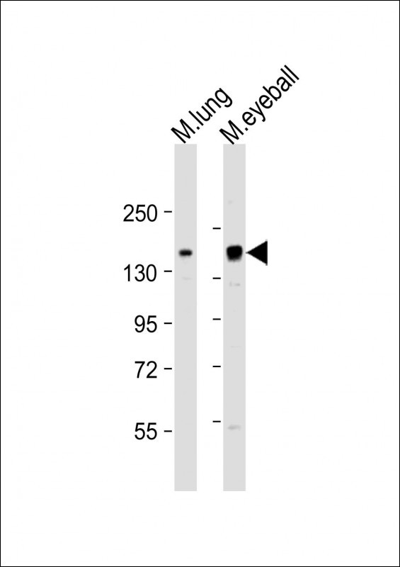 Rabbit Polyclonal Antibody to RBP3