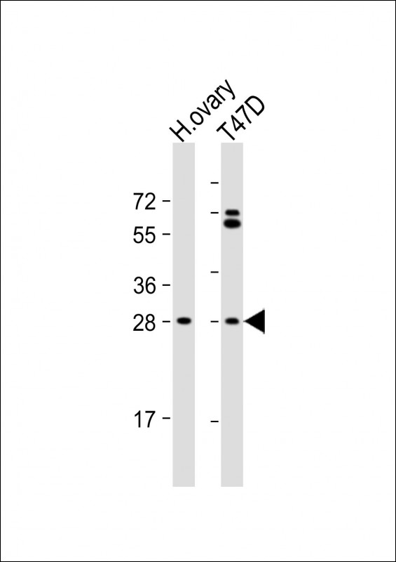 Rabbit Polyclonal Antibody to FIGLA