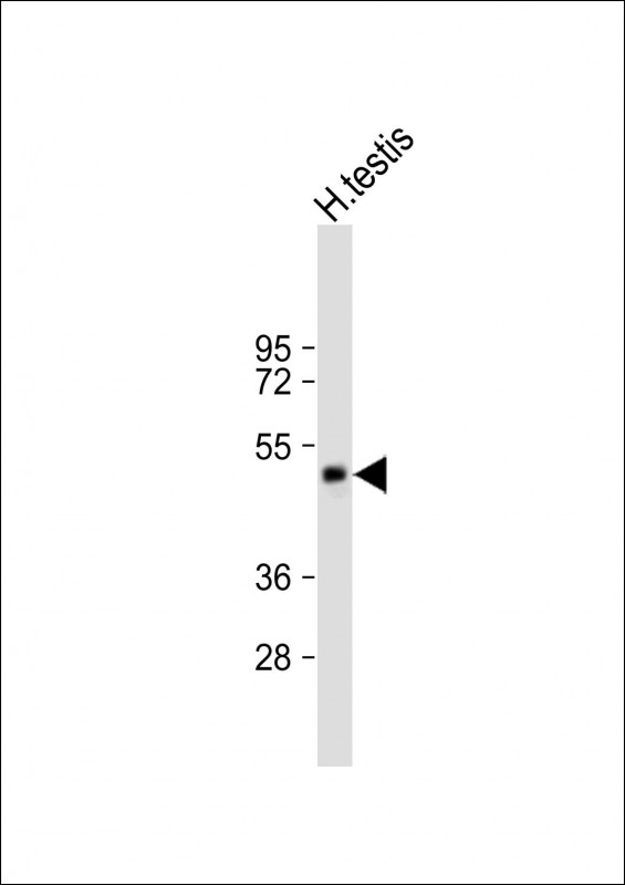 Rabbit Polyclonal Antibody to SPATA21