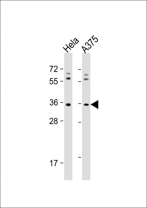 Rabbit Polyclonal Antibody to OR5AK2