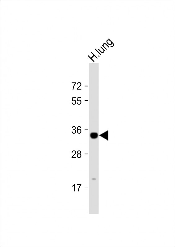 Rabbit Polyclonal Antibody to GNB4