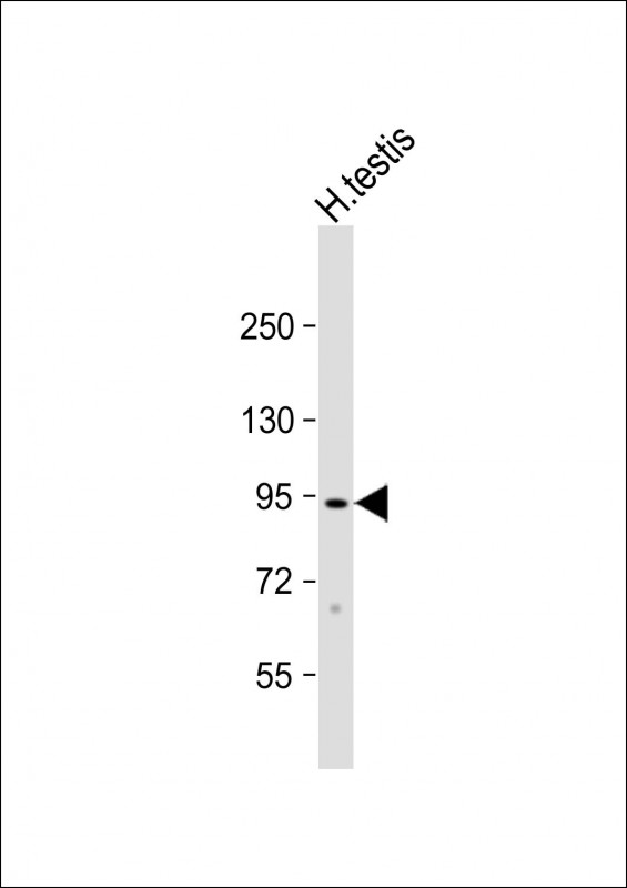 Rabbit Polyclonal Antibody to CTAGE1