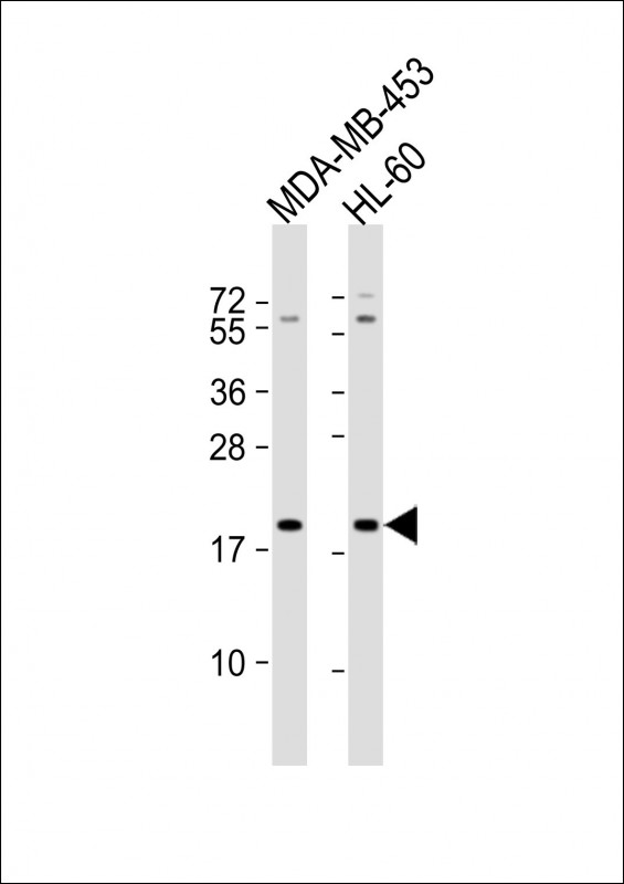 Rabbit Polyclonal Antibody to ZNF740 (N-term)