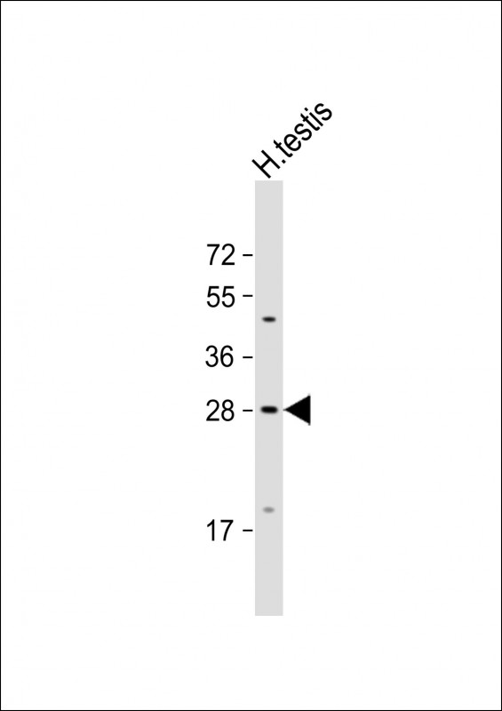 Rabbit Polyclonal Antibody to CXorf41