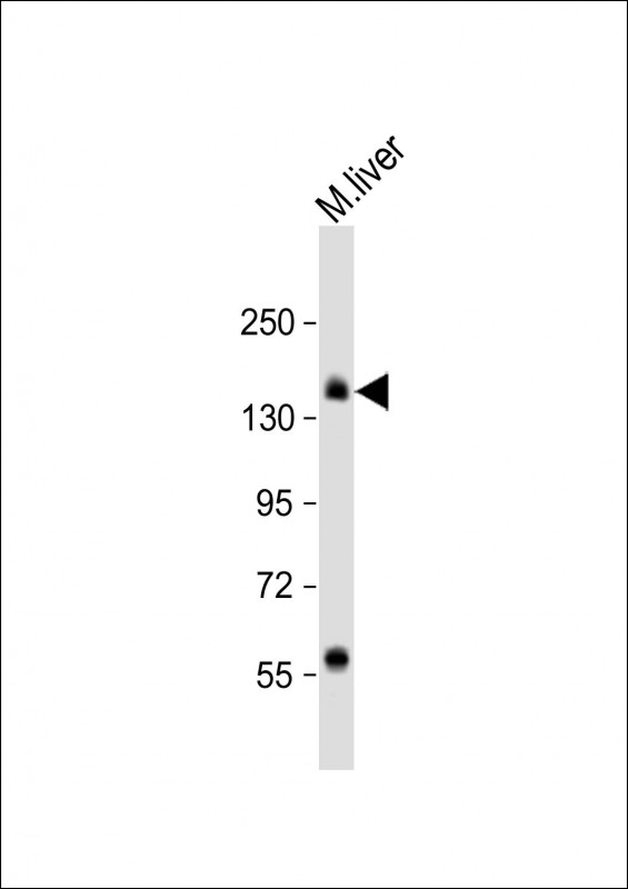 Rabbit Polyclonal Antibody to Mouse TSC1 (C-term S1138)