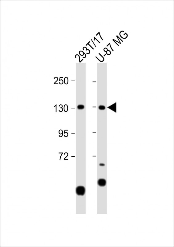 Rabbit Polyclonal Antibody to SGSM1