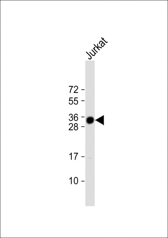 Rabbit Polyclonal Antibody to TMX1