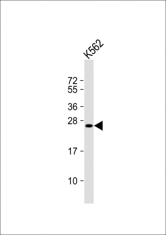 Rabbit Polyclonal Antibody to LRRC61