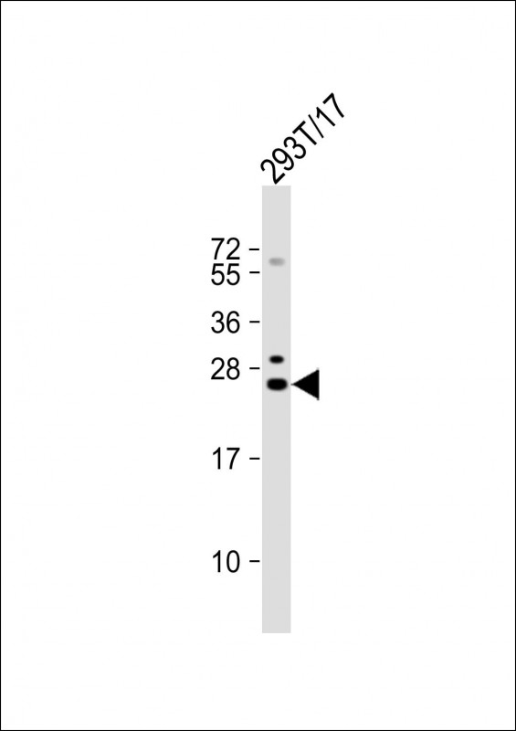 Rabbit Polyclonal Antibody to GINS3