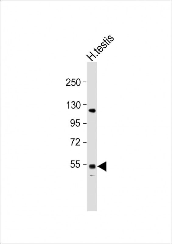 Rabbit Polyclonal Antibody to GOLGA6L2 (N-term)
